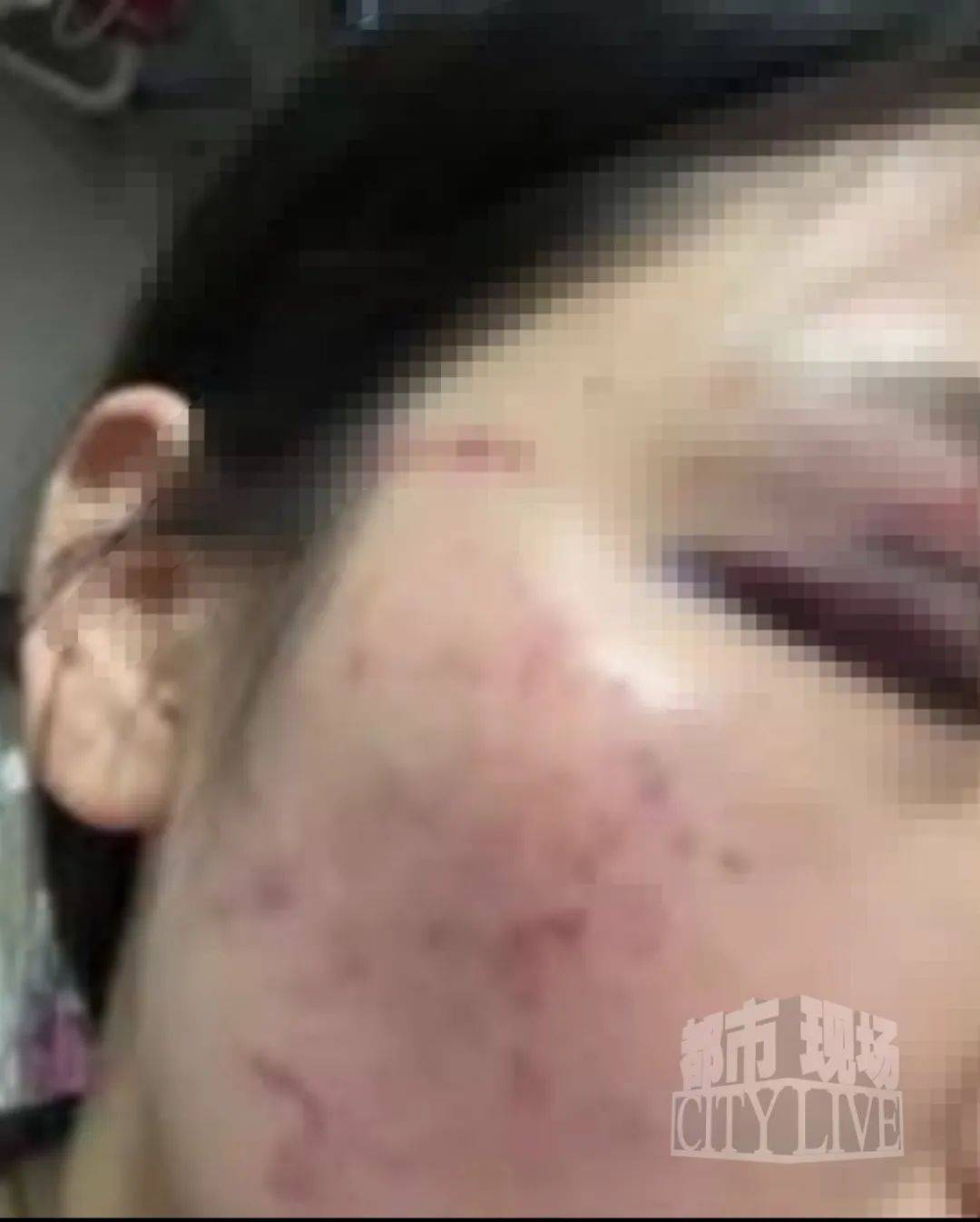 皇冠信用網最高占成_湖南衡阳29岁女子疑被男友施暴后从25楼跳下身亡 男友徐某此前还刺激说：“你放心皇冠信用網最高占成，她不会去死的”