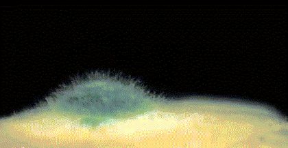 皇冠信用网代理
_6岁女童发烧17天皇冠信用网代理
,脑子竟被“啃”出十几个洞!“元凶”家中很常见!