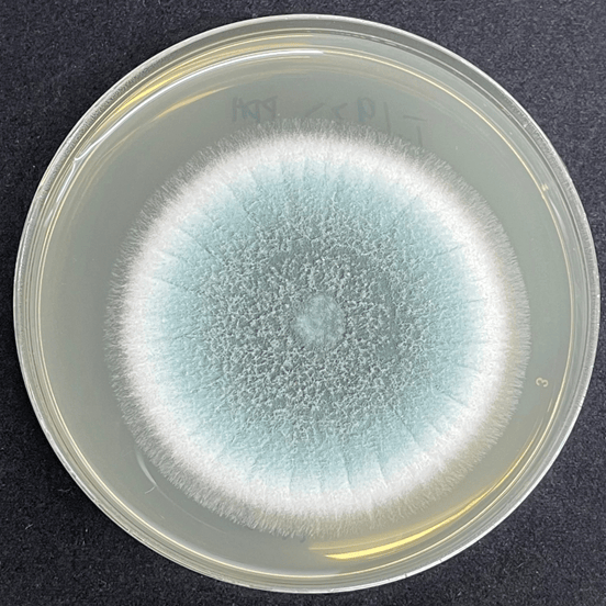 皇冠信用网代理
_6岁女童发烧17天皇冠信用网代理
,脑子竟被“啃”出十几个洞!“元凶”家中很常见!